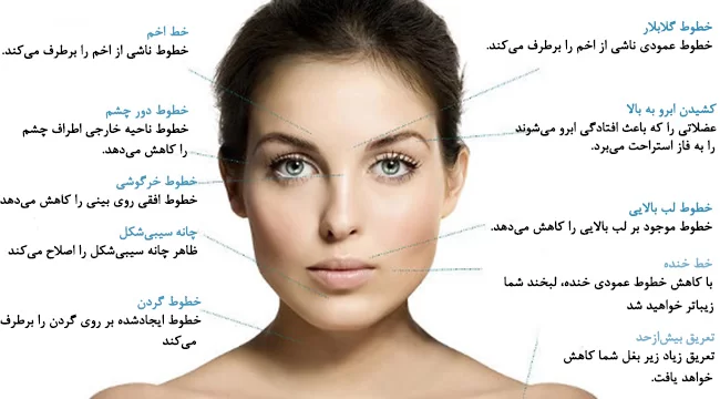 کاربردهای بوتاکس_دکتر پیمان چلبی زاده